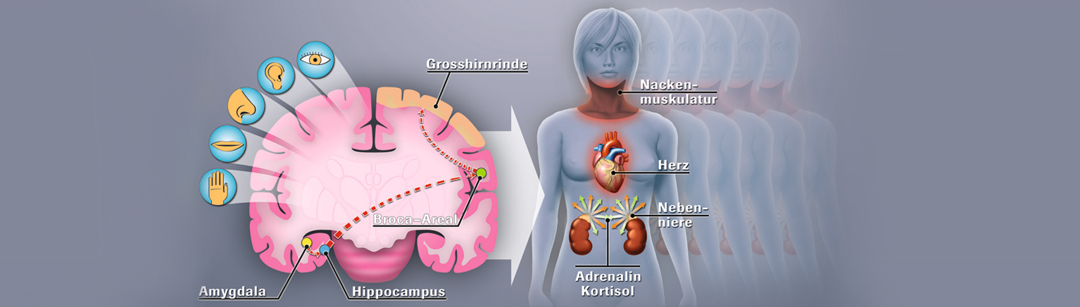 Stressgrafik_neuroimagination